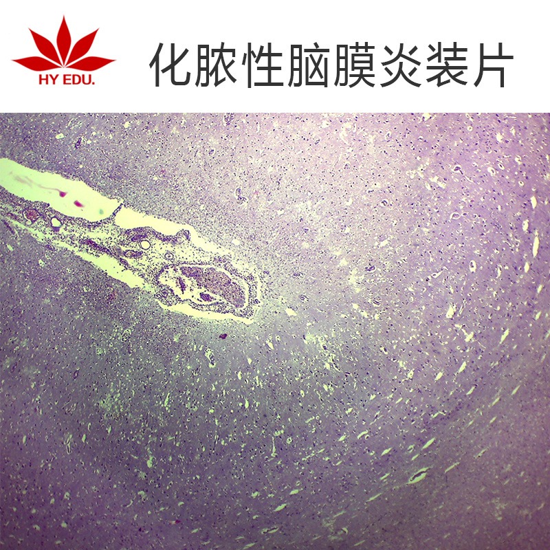 化脓性脑膜炎装片  高教标准  显微镜玻片 病理组织细胞 生物切片 成像清晰