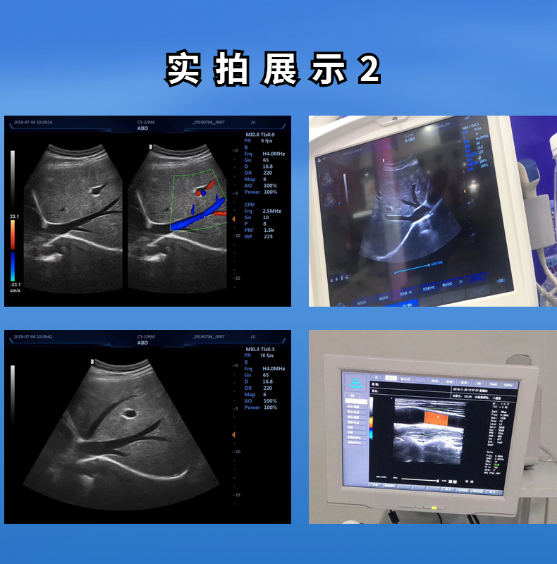 江苏徐州新玛彩超机器多普勒超声诊断仪推车款胎心仪图片